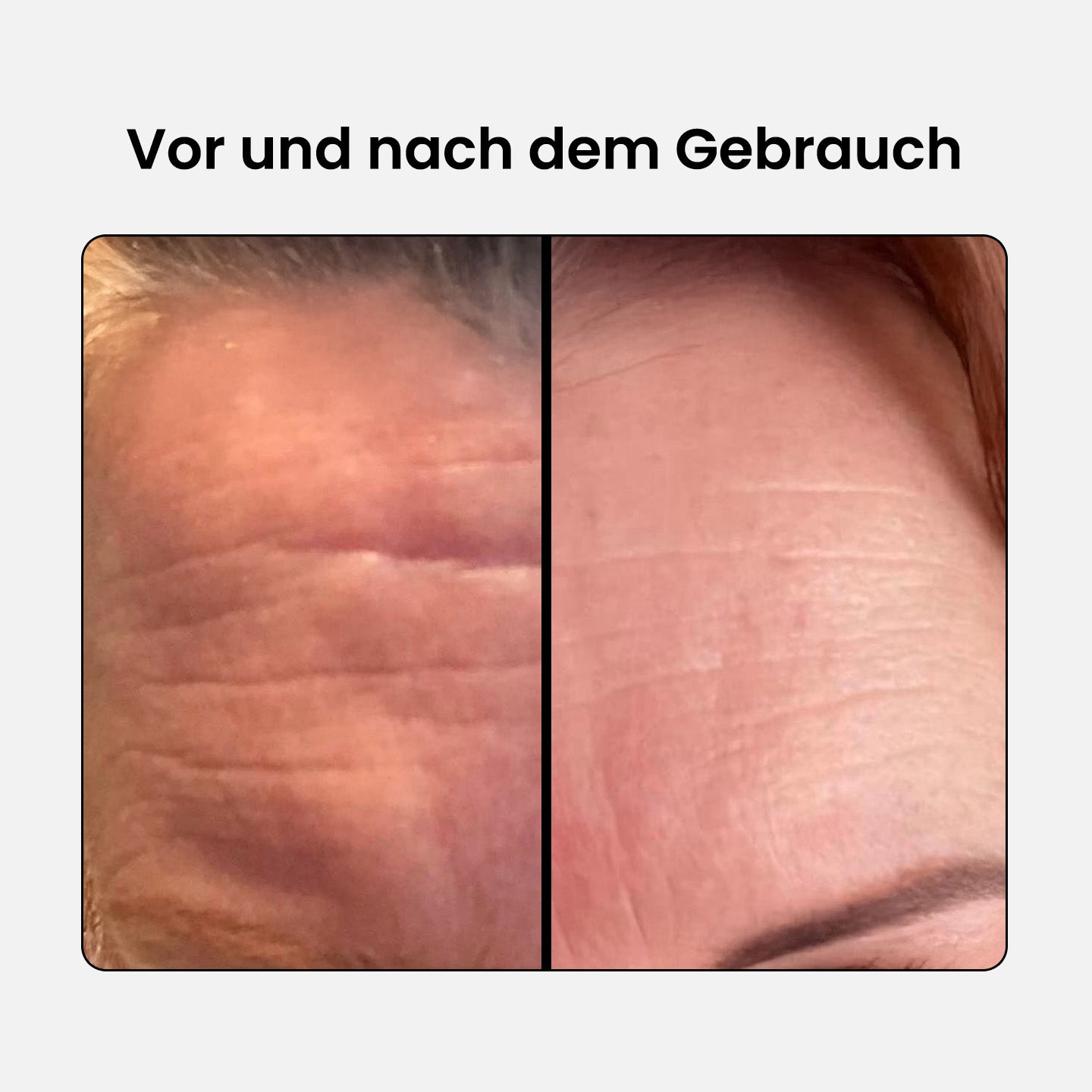Anti-Aging Kollagen Komplex