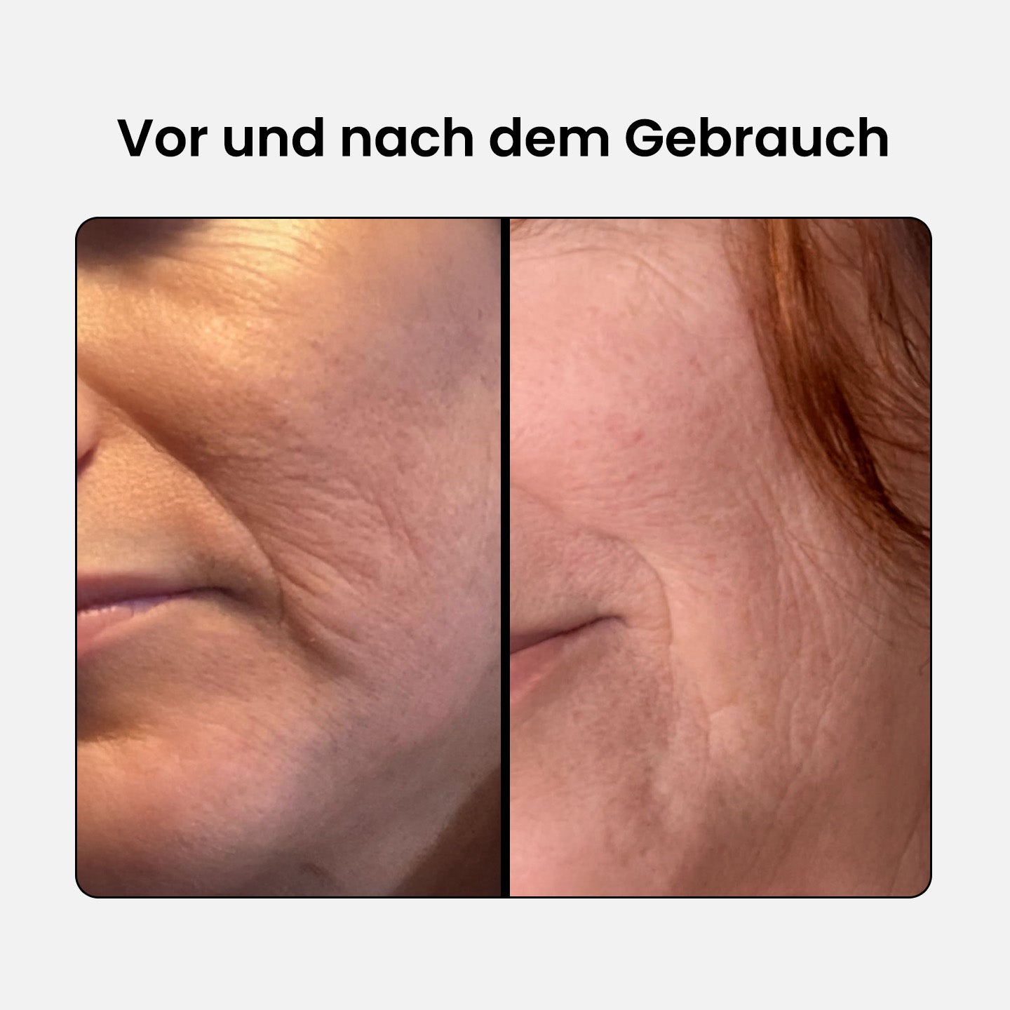 Anti-Aging Kollagen Komplex