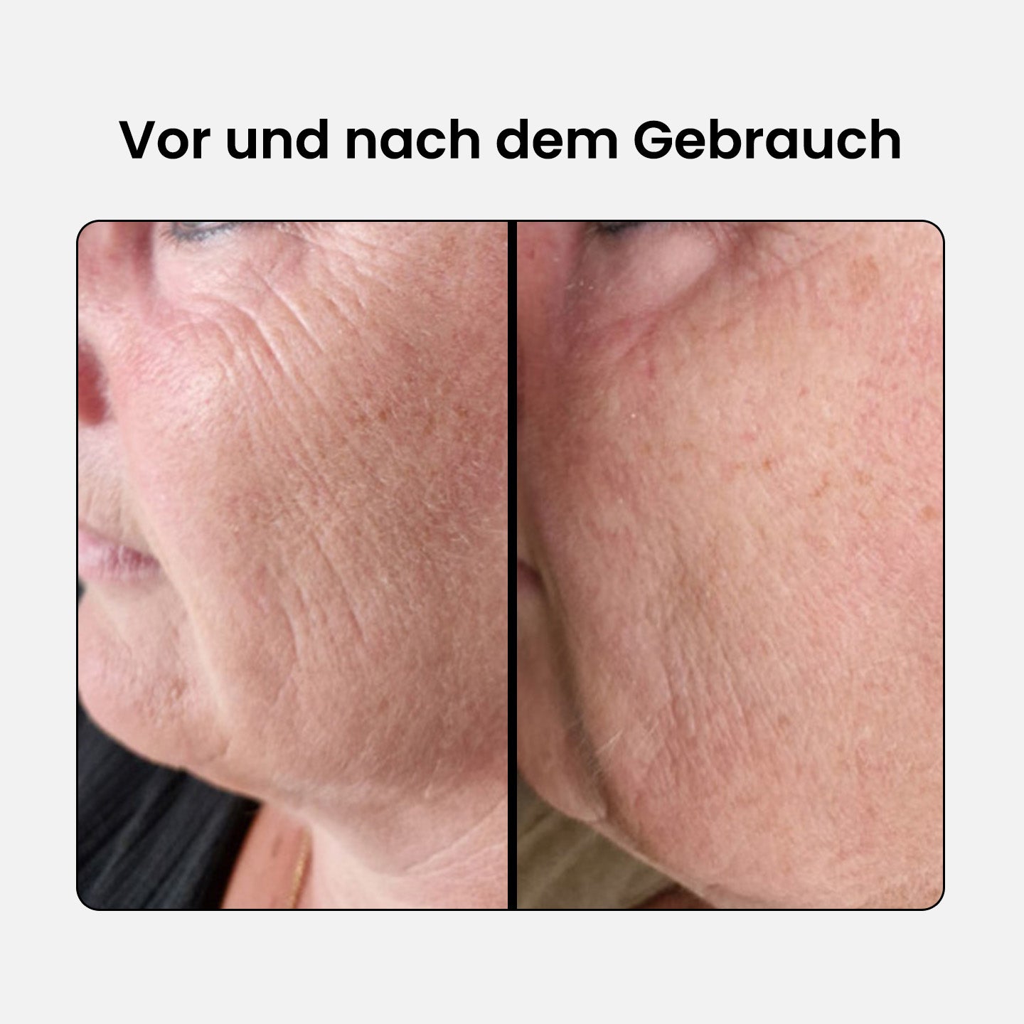 Anti-Aging Kollagen Komplex