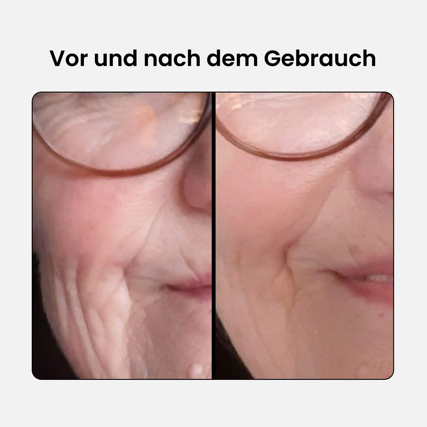 Anti-Aging Kollagen Komplex